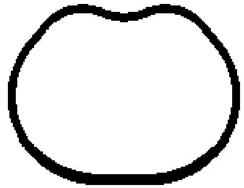 FORD EMME MANIFOLD TAKIM CONTA SILIKON FOCUS 1,6 16V BENZINLI 07>